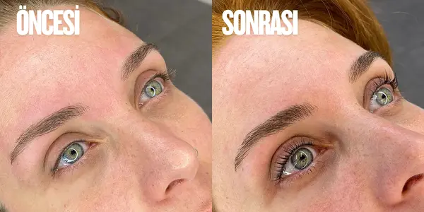 Kaş Tasarımı Öncesi - Sonrası